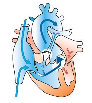 5. Development in Congenital Heart Disease Tetralogy of Fallot Pulmonary Stenosis Ventricular Septal