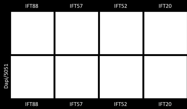 Top panel stained for IFT complex B members: IFT88, IFT57, IFT52, and IFT20.