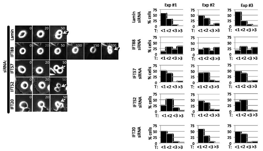 Figure III-6 Loss of IFT88, but not IFT57, IFT52, or IFT20 results in delayed mitotic progression.