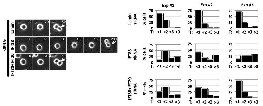 Figure III-11 Simultaneous depletion of IFT88 and IFT20 rescues delay in mitotic progression associated with IFT88-depletion alone.