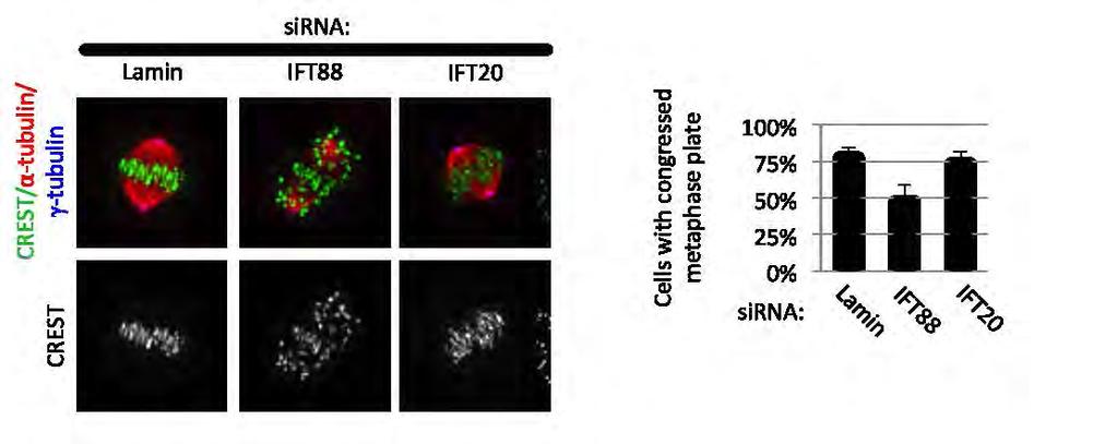 Figure III-13 Depletion of IFT88, but not IFT20 disrupts metaphase plate formation.
