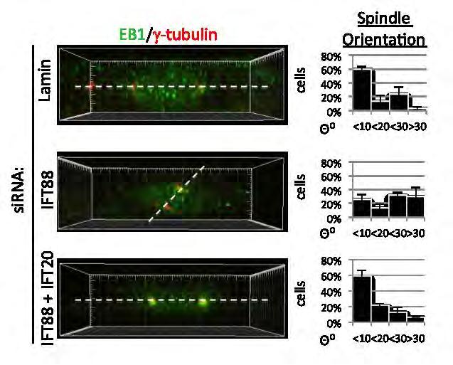 Figure III-16 Simultaneous depletion of IFT88 and IFT20 rescues mitotic spindle orientation.