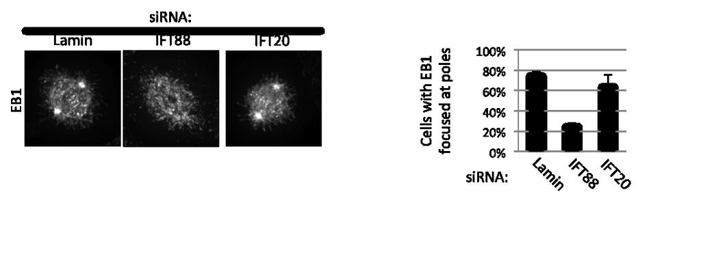 Figure III-18 Depletion of IFT88 but not IFT20 disrupts EB1 at spindle poles. Immunofluorescence microscopy images of mitotic HeLa cells stained for EB1.