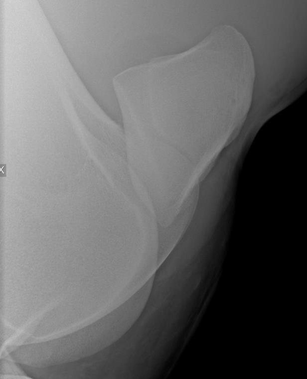 STIFLE ANATOMY - radiograph FEMUR PATELLA The Equine Stifle corresponds to the human knee.