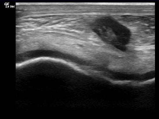 Defects in the cartilage and underlying bone are evident in the ultrasound images below (credit