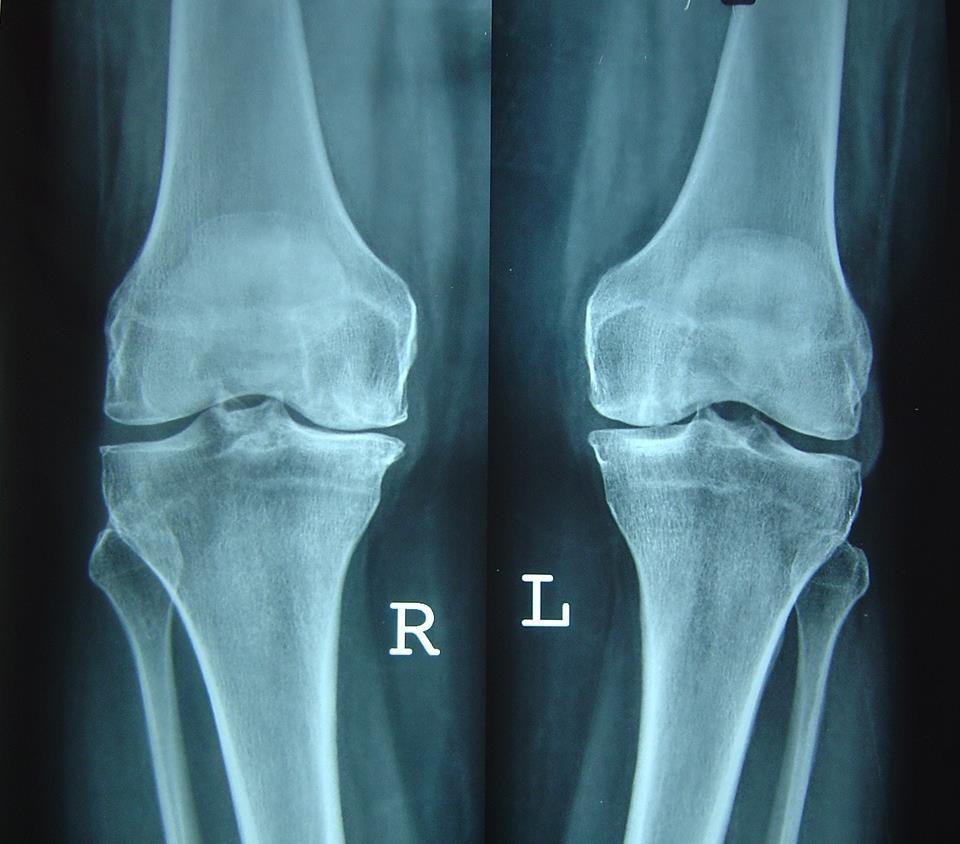 X rays at