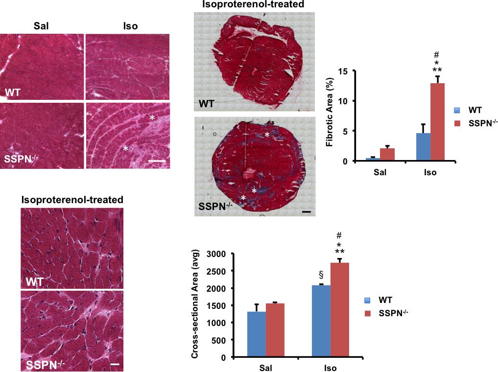 A B C D E Figure 3. Isoproterenol treatment alters cardiac architecture of SSPN-null mice.