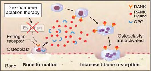 production by osteoblasts Increased levels of free RANK Ligand lead to osteoclast activation and