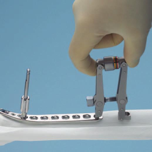 screw length. 7 Option: articulated tension device Instrument 321.
