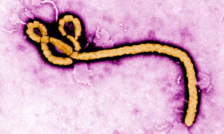 5 known Ebola viruses 4 infect humans Clinically almost identical to Marburg virus First