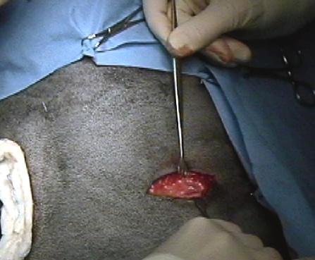 PLACING THE COMPANIONPORT Make a skin incision at the port placement site, generally the inner thigh.