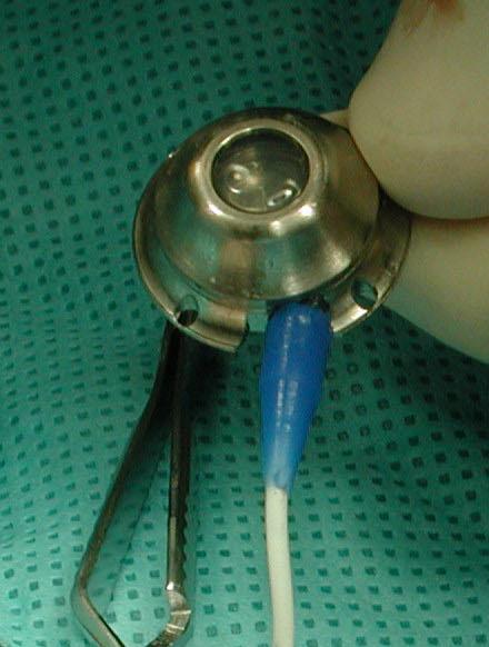 catheter to the correct length. AUS occluder with blue boot DO NOT REMOVE THE BLUE BOOT.