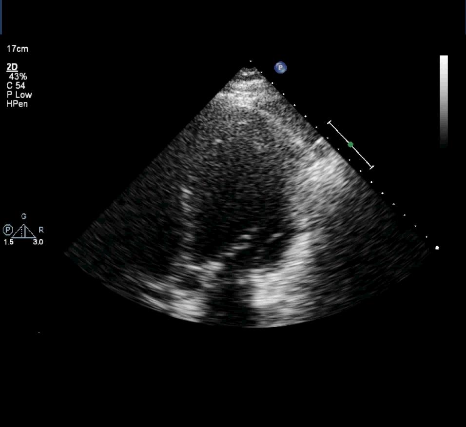 position Ensure that contrast was activated In stress images: bolus with saline