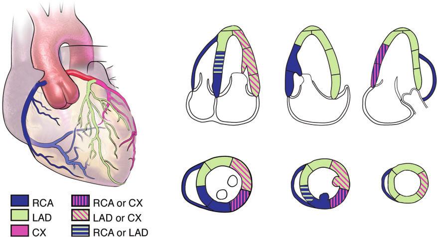 Recommendations for Cardiac Chamber Quantification by Echocardiography in Adults 245 Figure 5 Typical distributions of the right coronary artery (RCA), the left anterior descending coronary artery