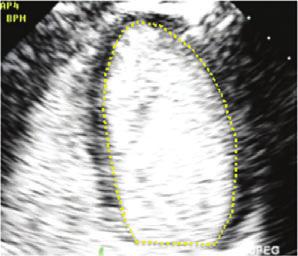 Recommendations for Cardiac Chamber Quantification by Echocardiography in Adults 237 Table 1 Continued Parameter and method Technique Advantages Limitations.