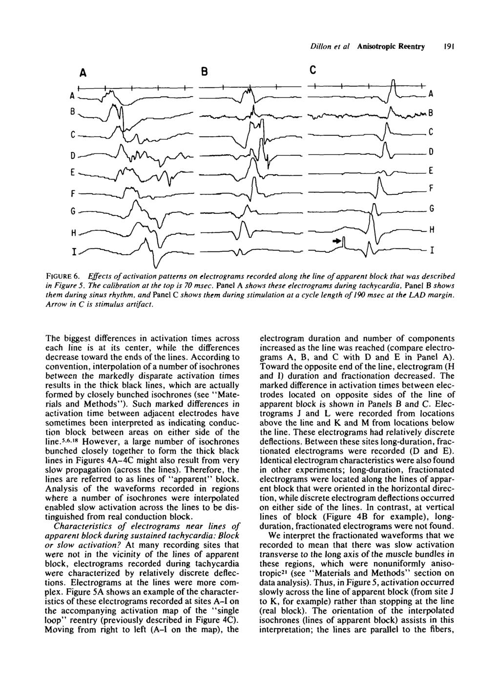 Dillon et al Anisotroplc Reentry 191 FIGURE 6. Effects of activation patterns on electrograms recorded along the line of apparent block that was described in Figure 5.