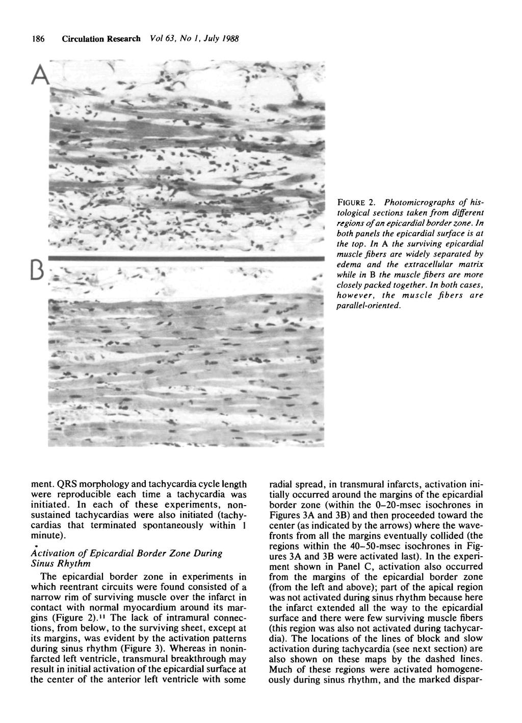 186 Circulation Research Vol 63, No 1, July 1988 2. Photomicrographs of histological sections taken from different regions of an epicardial border zone.