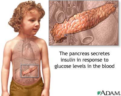 absolute or relative insufficiencies of insulin, a hormone produced by the pancreas. Insulin is a key regulator of the body's metabolism.
