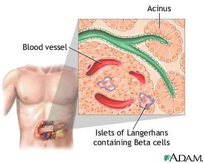 Beta cells in the pancreas that produce insulin are gradually destroyed. Eventually insulin deficiency is absolute.