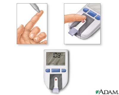 Glycemic index (for tracking which carbohydrate foods increase blood sugar) Monitoring Tests for Glucose Levels.