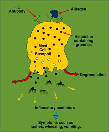 IgE mediated allergic reactions Majority of food-induced reactions.