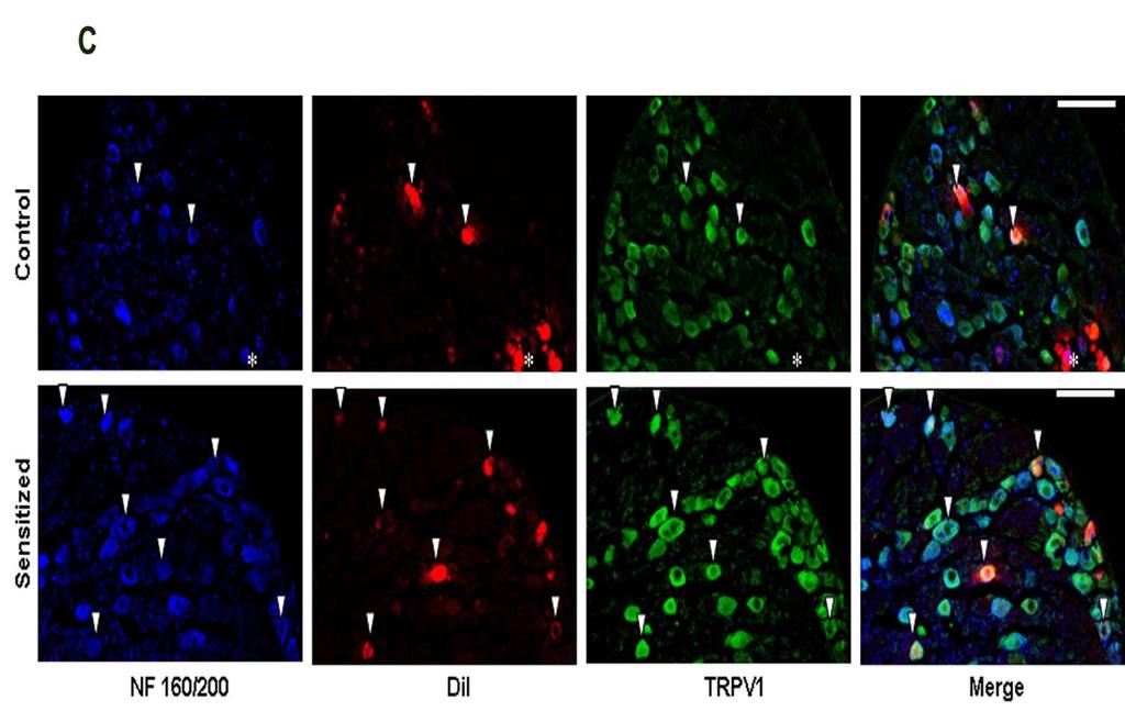 Fig. 4 Fig. 5 Fig. 4. Activation of PAR 2 potentiates the capsaicin-evoked whole-cell inward current in isolated rat vagal pulmonary sensory neurons. Fig. 5. PAR 2 -AP potentiates single-channel activity of TRPV1 in cell-attached patches from rat pulmonary sensory neurons.