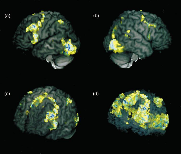 2 FUNCTIONAL MRI AT HIGH FIELDS: PRACTICE AND UTILITY Figure 1 Three-dimensional, whole brain images of activation during a language task based on word generation from a phoneme.
