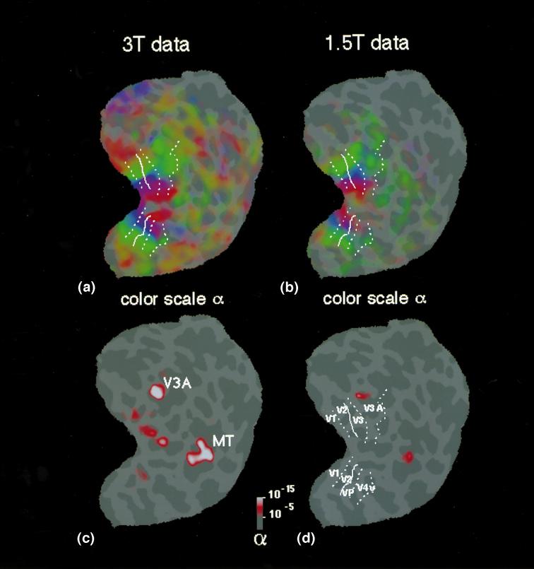 FUNCTIONAL MRI AT HIGH FIELDS: PRACTICE AND UTILITY 3 Figure 2 Mapping eccentricity and motion versus stationary stimulus in the visual cortex. Images are presented as a attened cortex.