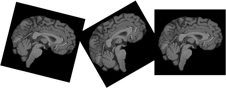 fmri Acquisition: Temporal Effects Session length Repetition time Fixed vs.