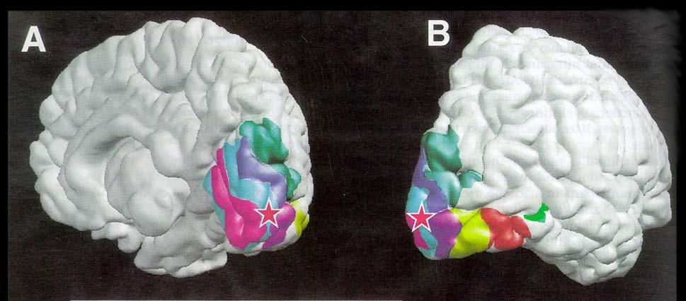 In 1994, only two or three areas had been identified in human visual cortex. Two years later, Tootell et al published this map, containing ten visual areas. Courtesy Elsevier, Inc.