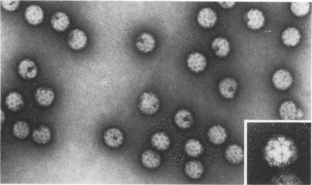 VOL. 16, 1975 SINDBIS SURFACE LATTICE 143 FIG. 3. Field of Sindbis virus particles negatively stained with uranyl acetate.
