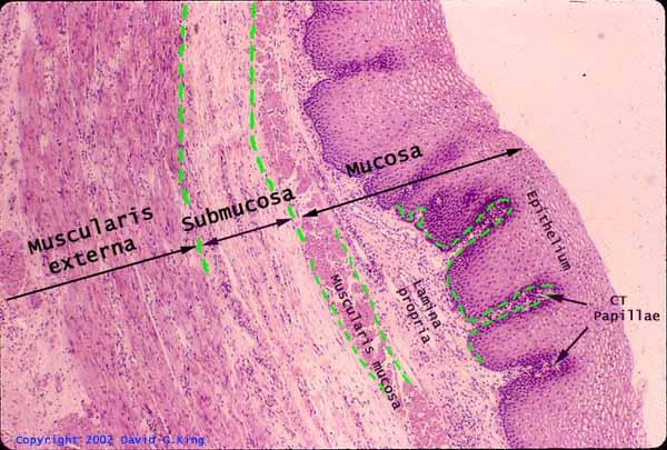 submucosa and muscularis propria Two