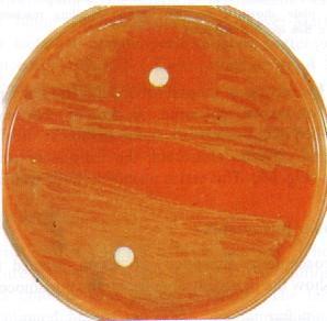 Procedure Inoculate blood agar plate with the test organism. Aseptically apply Optochin disc onto the center of the streaked area.