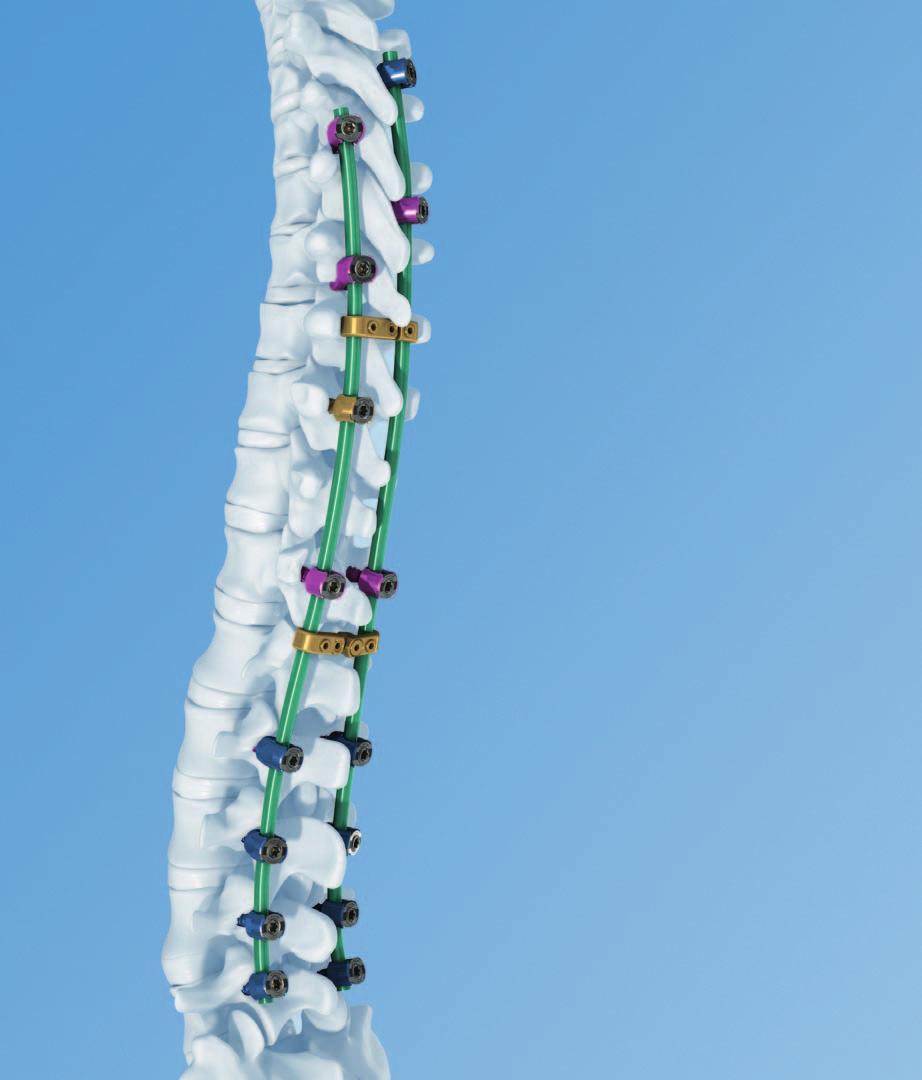 Technique Guide Pangea Spine System.