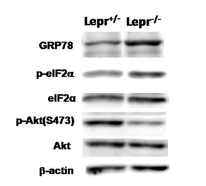 T. MATSUDA et al. Figure 3 Immunoblot analysis in islets of Lepr +/- and Lepr -/- mice.