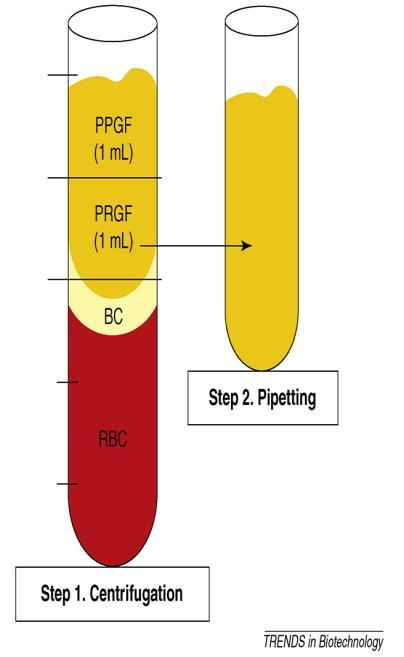29 P-PRP: PRP không có bạch cầu Bước 2A: ly tâm cứng L-PRP: PRP có ít bạch cầu Bước 2B: ly tâm cứng Bước 2: tách PRP Bước 1: ly tâm mềm Quy trình ly tâm 2 lần Bước 1: ly tâm Quy trình ly tâm 1 lần