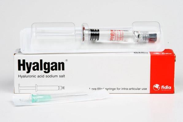 56 Nhóm chứng tiêm acid hyaluronic (Hyalgan): - Thuốc acid hyalorunic (Hyalgan) của hãng Fidia, Itali, mỗi ống tiêm 2 ml chứa 20 mg sodium hyalorunate trọng lượng phân tử thấp (500-730 kdalton): Hình