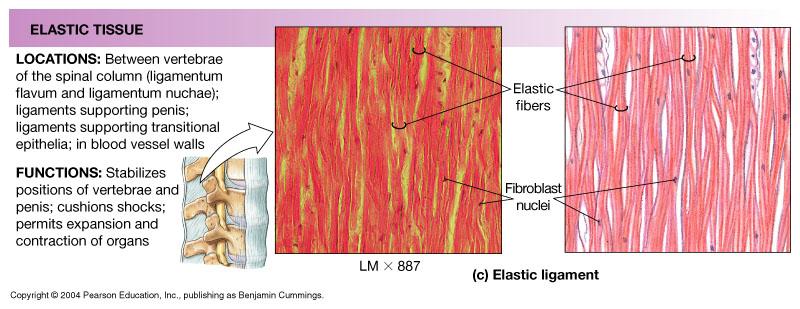 DENSE ELASTIC TISSUE Made mostly of elastic fibers For example, elastic ligaments between spinal