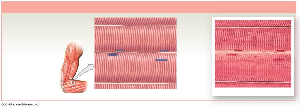 MUSCLE TISSUE Specialized for contraction Three types Skeletal muscle : Striated and voluntary Cardiac muscle : Striated and involuntary Smooth muscle : not striated and involuntary Striations in