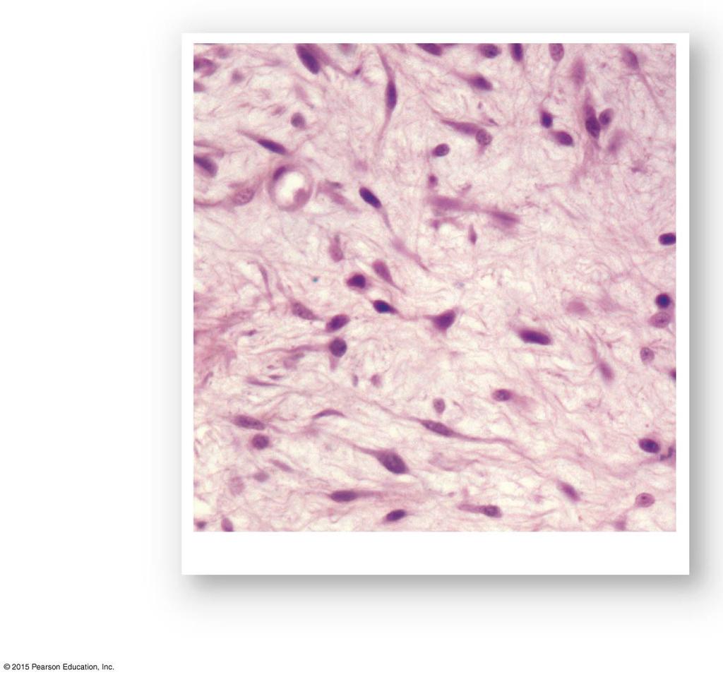Mesenchyme Mesenchyme Tissue is Embryonic Connective Tissues Is not found in adults, but mesenchyme cells remain in many connective tissue proper It can differentiate into new connective tissues when