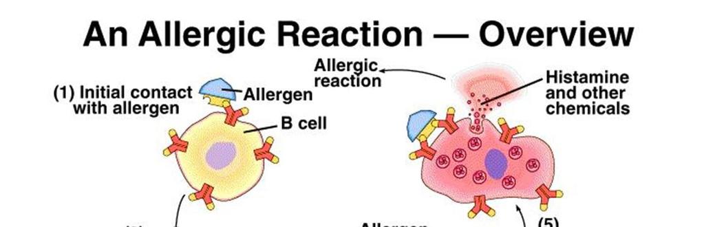 Mast cells secretion (degranulation) 1. Initial contact with alergen with B lymphocytes 2. IgE molecules production by plasma cells 3.