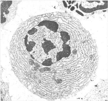 Plasma cells B lymphocyte + antigen B lymphoblast (mitotic division) B lymphocyte + plasma cell large,