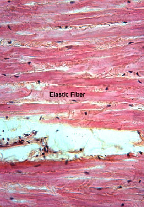 fibroblasts is found in yellow ligaments of the vertebral column, suspensory