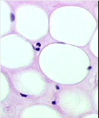 Unilocular (common or yelow) adipose tissue Large depot of energy for organism Lipids in adipose cells triglycerides, glycerol Adipose cells can synthesize fatty acids from glucose insulin Metabolism