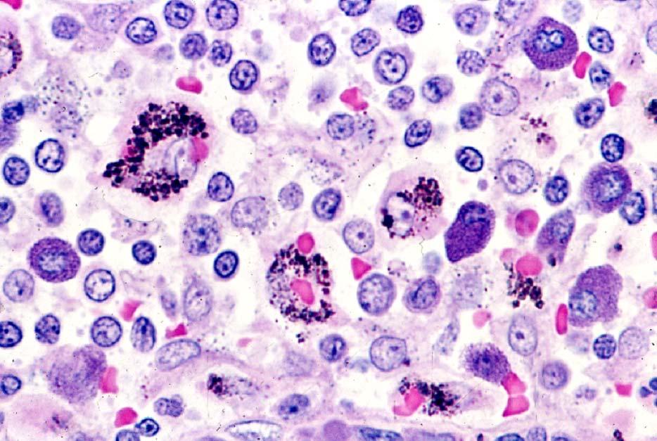 03-14. Macrophases 2 and mast cells.