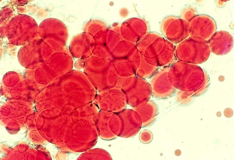 03-17. Fat cells 1.