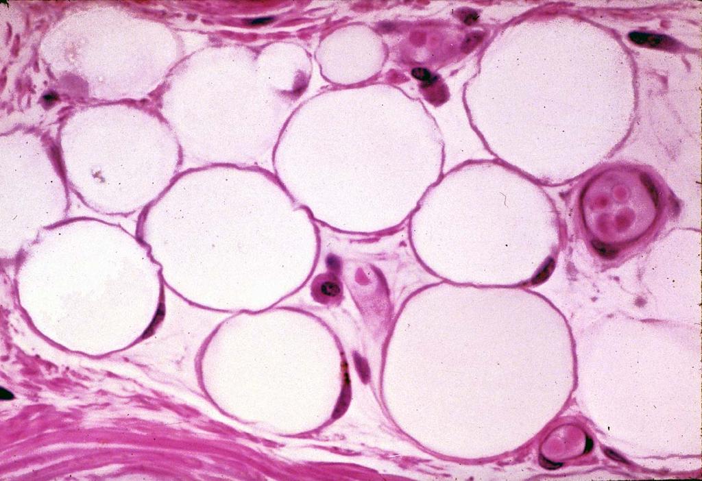 03-18. Fat cells 2.