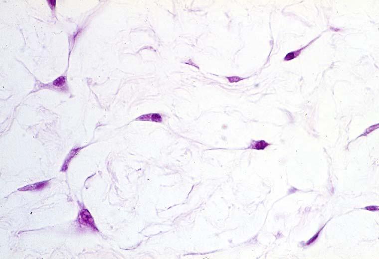 03-03. Mucous connective tissue 2.