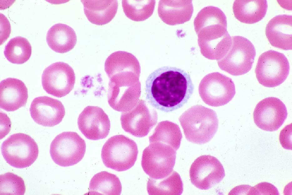 03-46. Small lymphocyte 1.