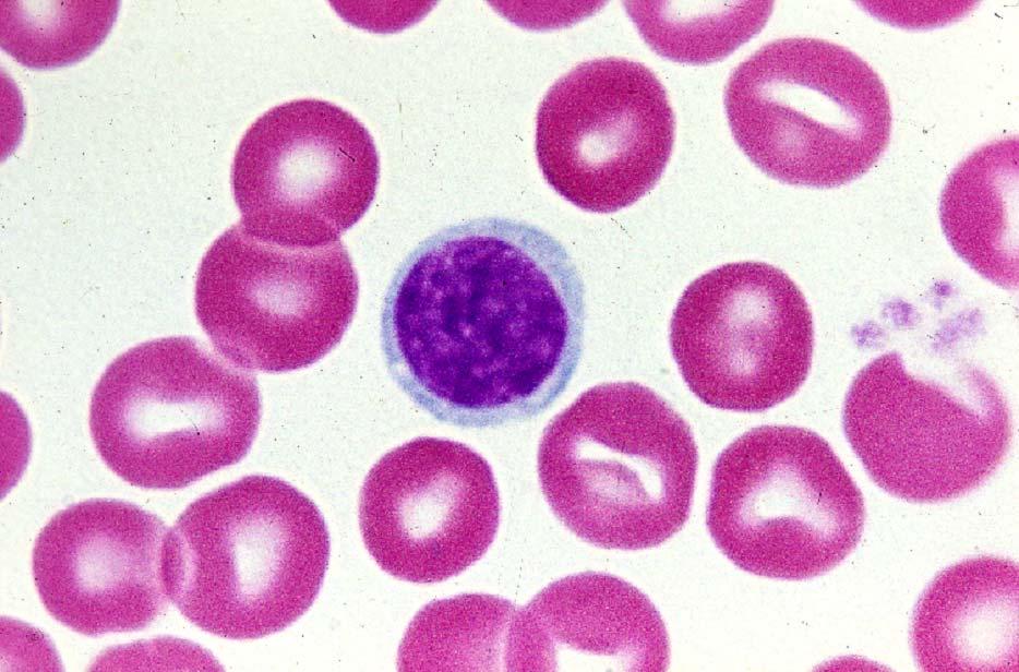03-47. Small lymphocyte 2.